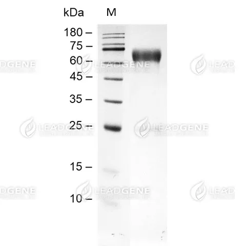 SDS-PAGE analysis of recombinant human MMP8.